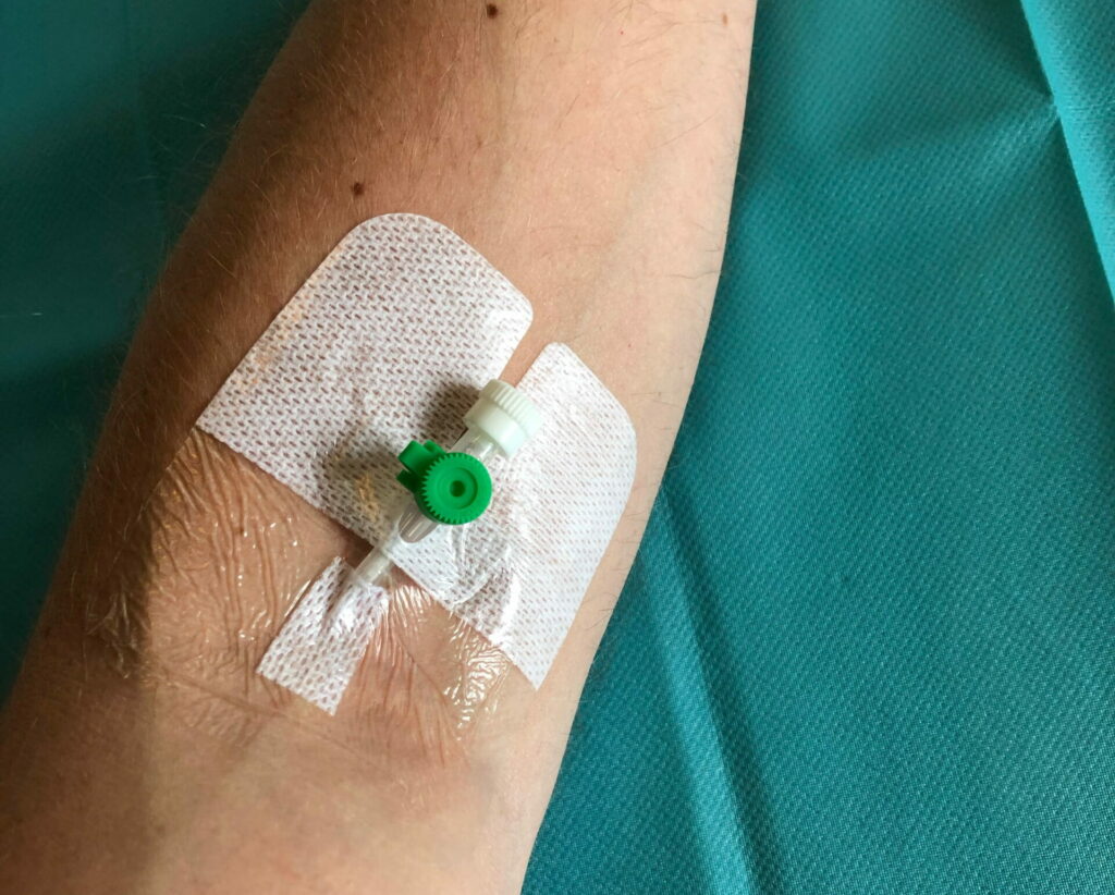 Gauze around a liquid IV needle in somebody's arm.